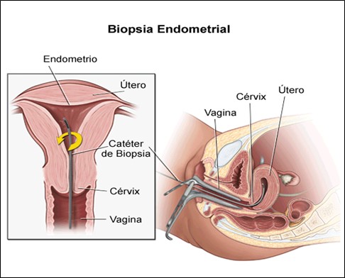 Endométrio