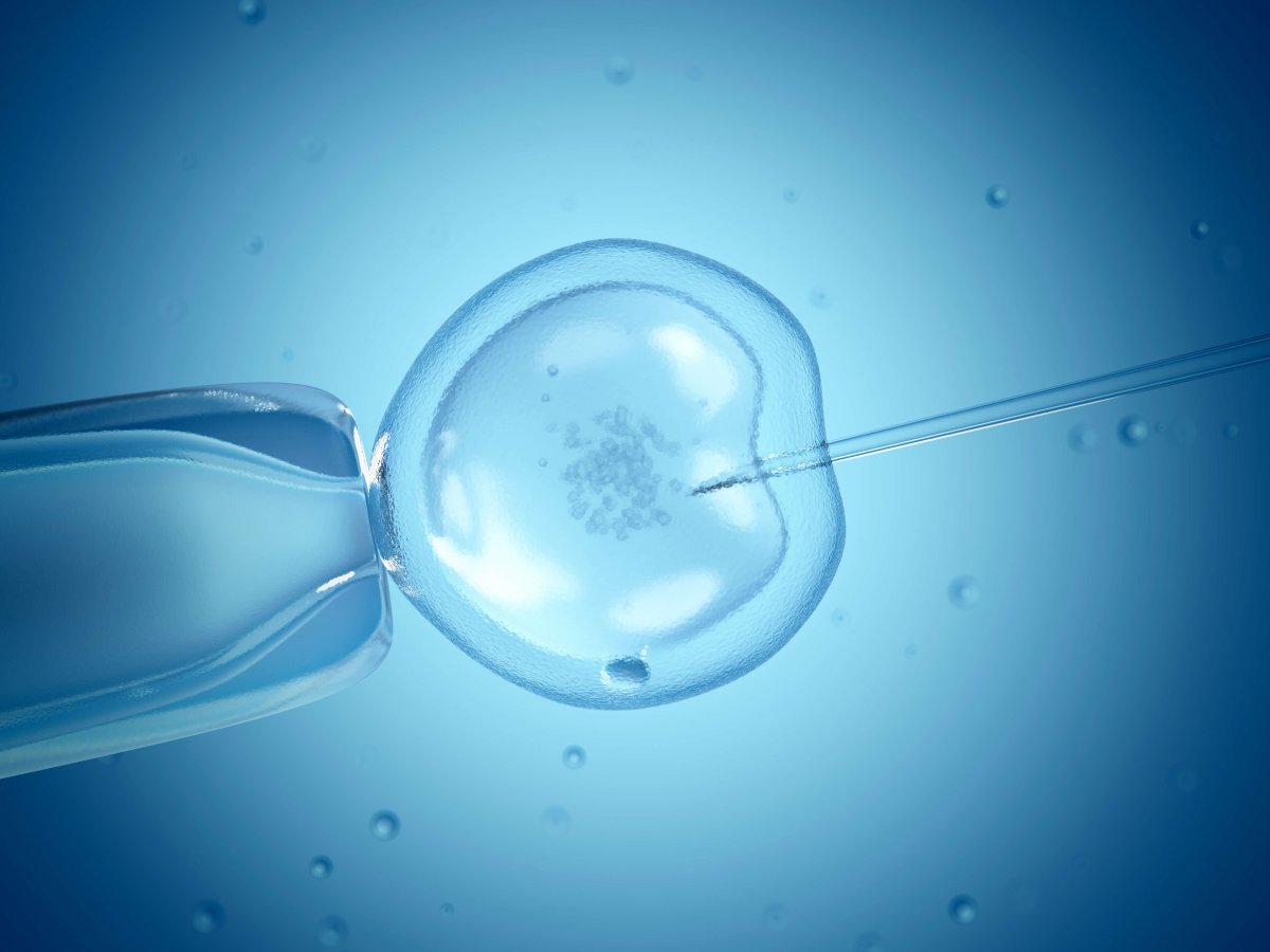 Fertilização in vitro: riscos e precauções para o bebê